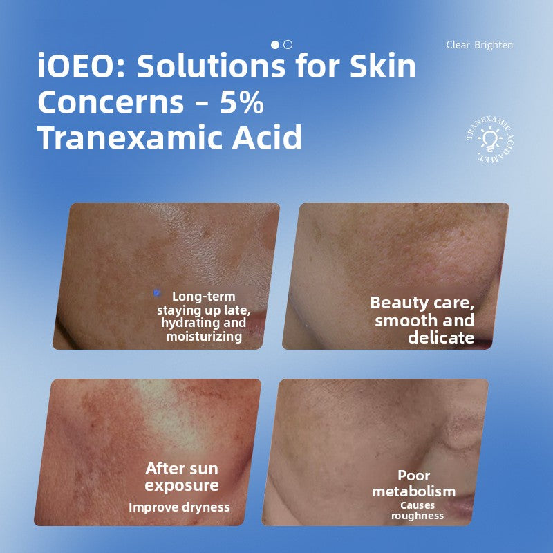 ioeo 5% Tranexamic Acid Brightening Hydrating Facial Essence 30ml teemdrop