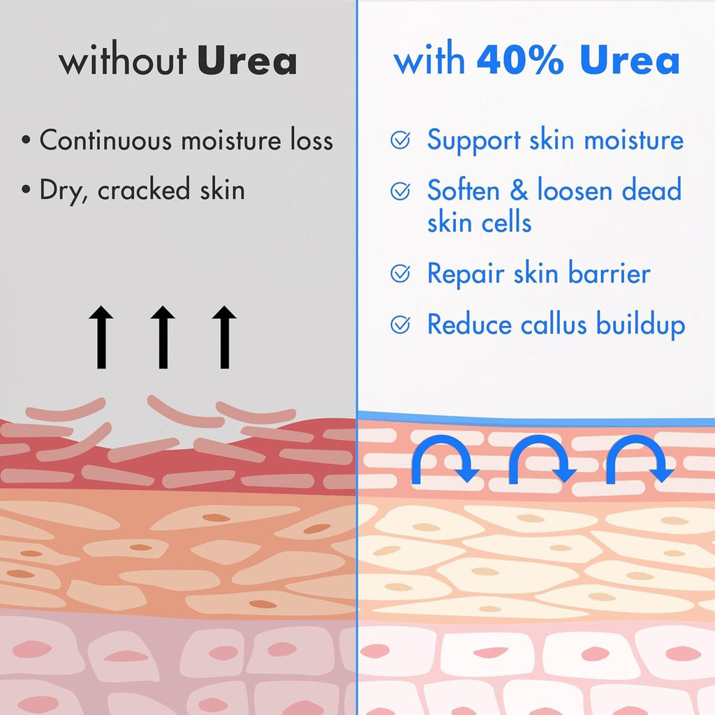 Salicylic Acid Urea Deep Moisturizing Face Cream, Natural Beeswax and Honey Nourishing Skin Softening Balm, Multi-Scent Options teemdrop