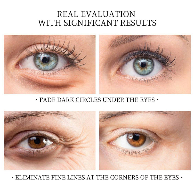 Gold eye mask for dark circles and hydration