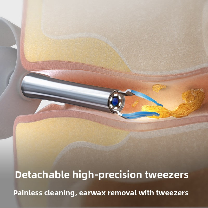 High-Definition Visual Ear Cleaning Tool Endoscope teemdrop