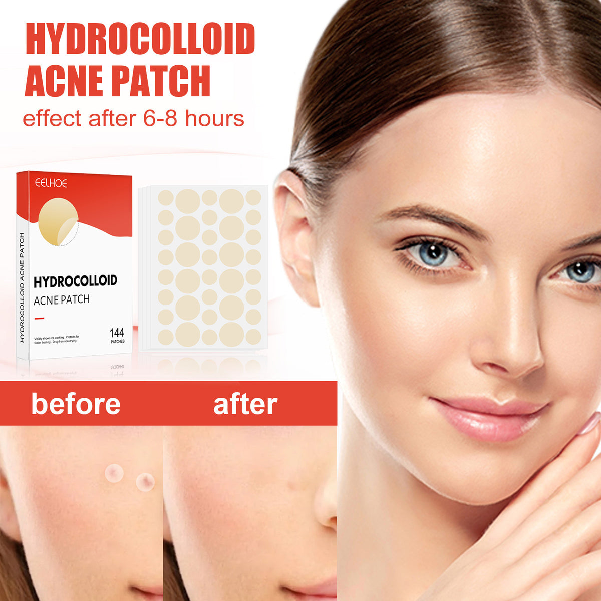 Hydrocolloid acne patch teemdrop