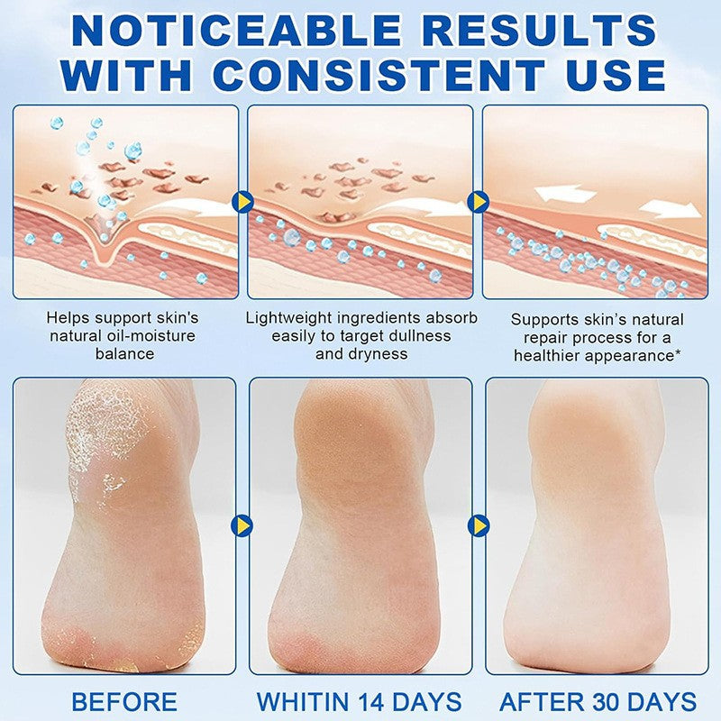 Salicylic Acid Urea Cream Foot Moisturizer