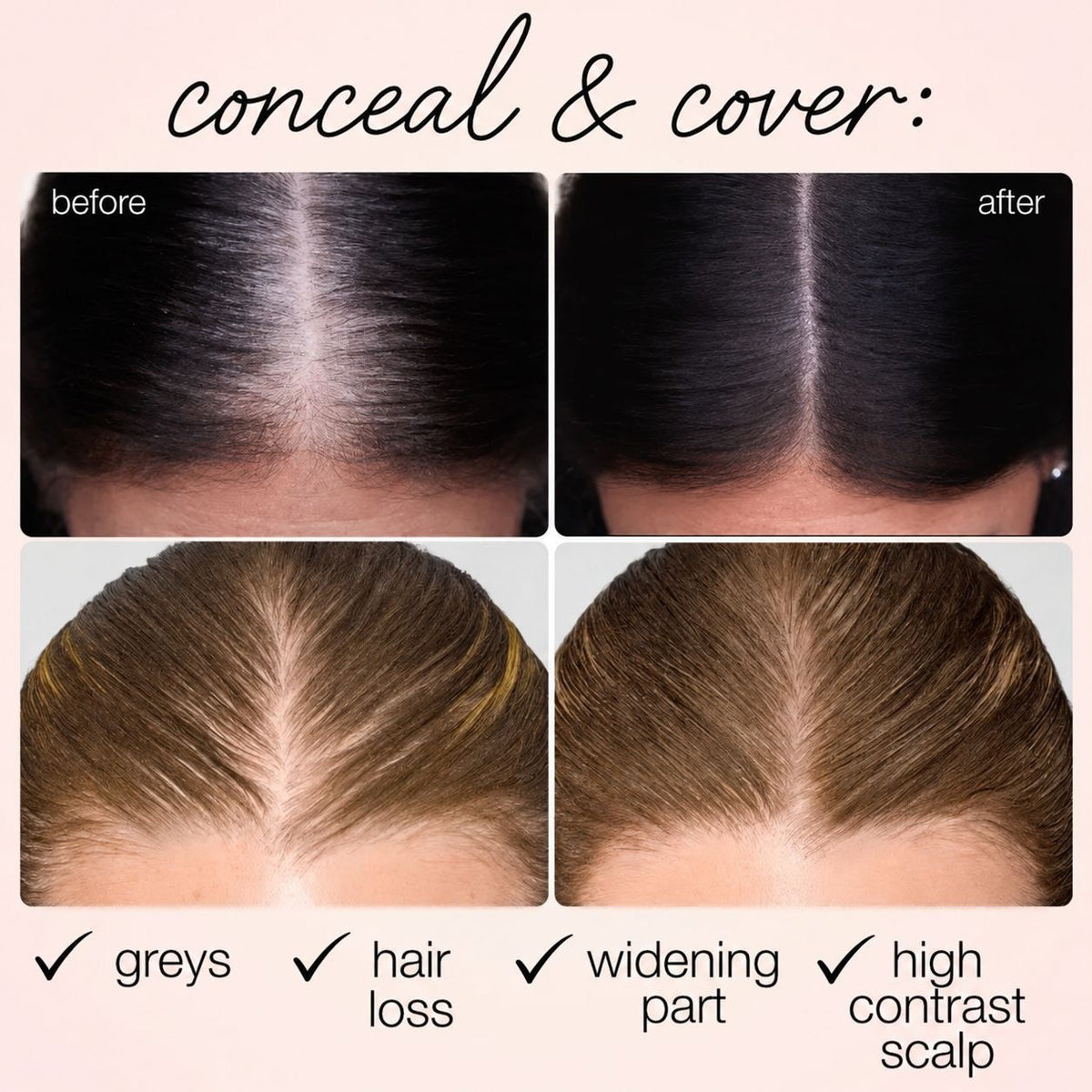 Refreshing and Non-Greasy Scalp Concealer teemdrop
