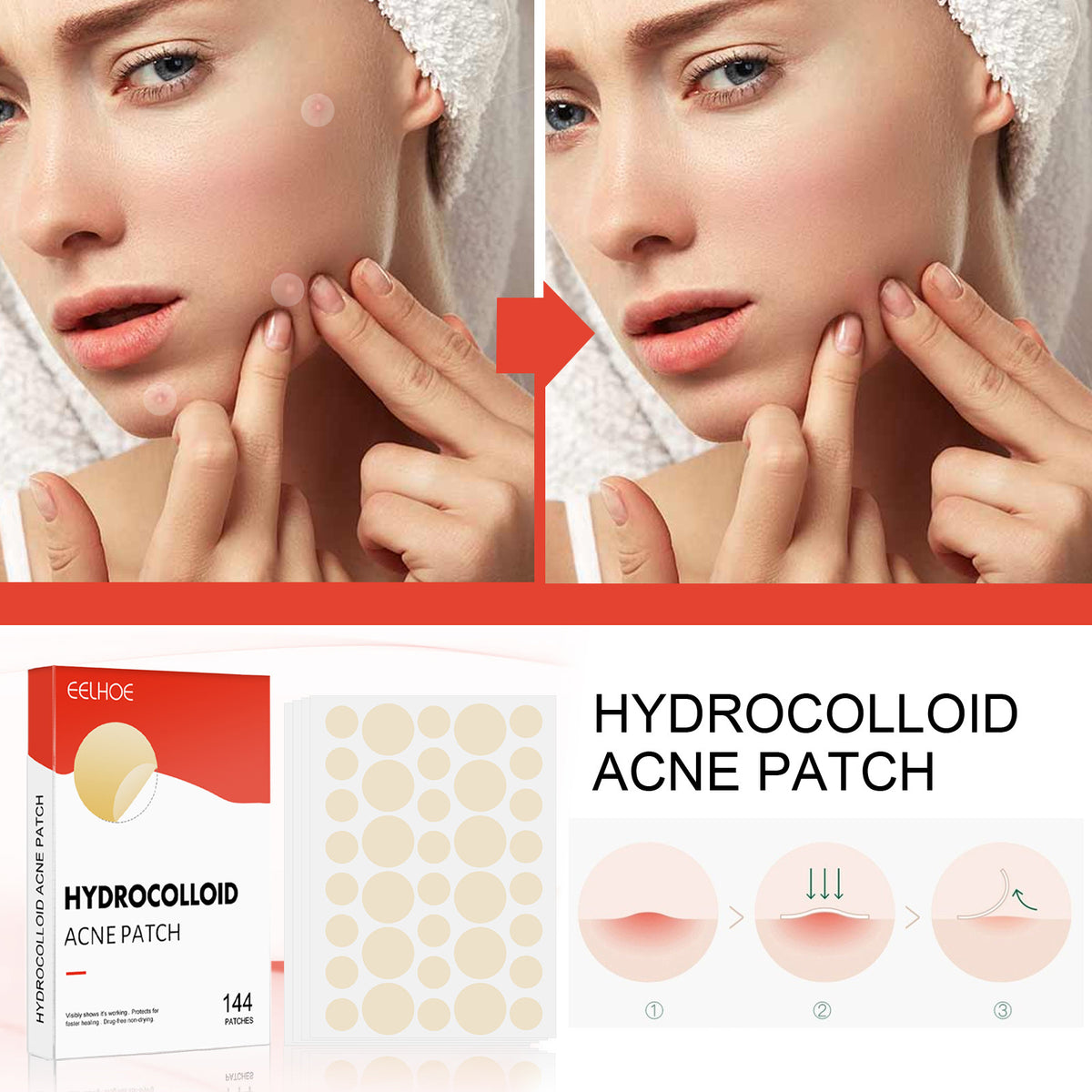 Hydrocolloid acne patch teemdrop