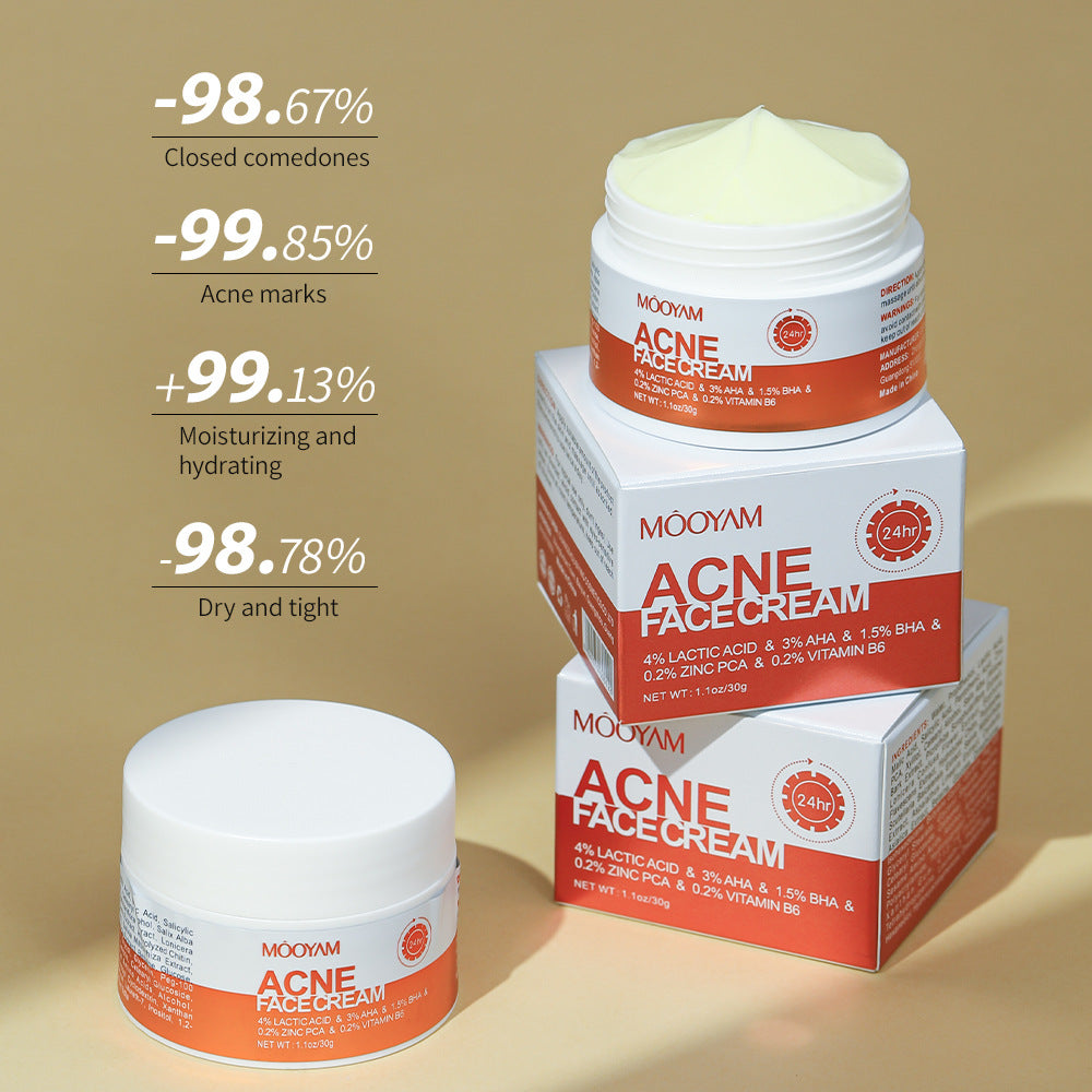 Acne treatment facial cream